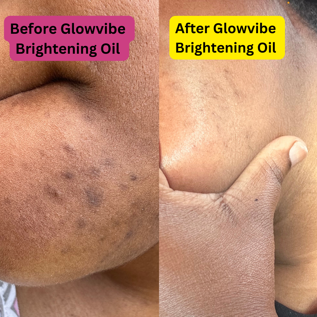 GlowVibe – Natural Brightening Oil for Inner Thighs & Bikini Line